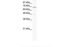 Image no. 1 for anti-Calcium Channel, Voltage-Dependent, beta 2 Subunit (CACNB2) (AA 523-572) antibody (ABIN6735457)