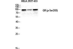 Western Blot (WB) analysis of HeLa 293T 453 cells using Phospho-GR (S203) Polyclonal Antibody. (GR (pSer203) anticorps)