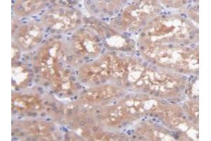 IHC-P analysis of Human Kidney Tissue, with DAB staining. (GOT1 anticorps  (AA 1-413))