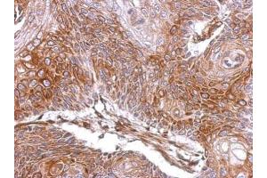 IHC-P Image Immunohistochemical analysis of paraffin-embedded Cal27 xenograft, using ELA3A, antibody at 1:500 dilution. (Elastase 3A anticorps)