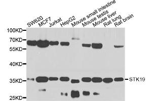 Western blot analysis of extracts of various cell lines, using STK19 antibody. (STK19 anticorps)