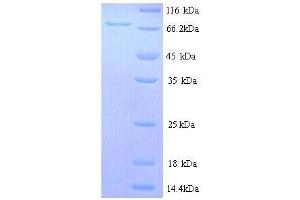 Estrogen Receptor 1 (ESR1) (AA 1-595) protein (His tag) (Estrogen Receptor alpha Protein (AA 10-595) (His tag))