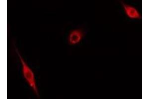 ABIN6276631 staining Hela cells by IF/ICC. (CDC20 anticorps  (N-Term))