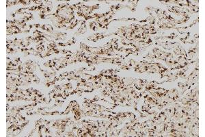 ABIN6268880 at 1/100 staining Human lung tissue by IHC-P. (FASL anticorps  (Internal Region))