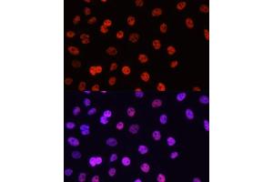 anti-Histone H3 (H3) (H3R17me) antibody