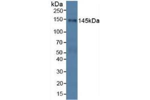 Western blot analysis of Human HeLa cells. (PALLD anticorps  (AA 1137-1383))