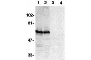 Western Blotting (WB) image for anti-BCL2-Associated Athanogene 4 (BAG4) (N-Term) antibody (ABIN1031581)