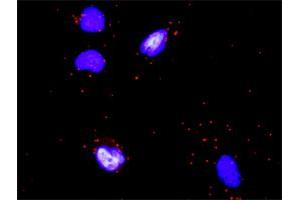 Proximity Ligation Analysis of protein-protein interactions between OSM and COL4A6.