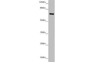 Western blot All lanes: ZNF169 antibody at 5. (ZNF169 anticorps  (AA 1-85))