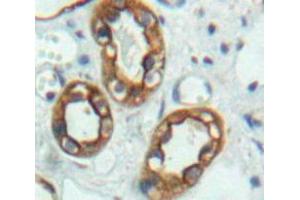 Used in DAB staining on fromalin fixed paraffin-embedded Kidney tissue