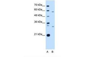 Image no. 2 for anti-CD36 (CD36) (N-Term) antibody (ABIN6738418) (CD36 anticorps  (N-Term))