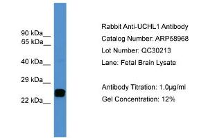 WB Suggested Anti-UCHL1  Antibody Titration: 0. (UCHL1 anticorps  (C-Term))