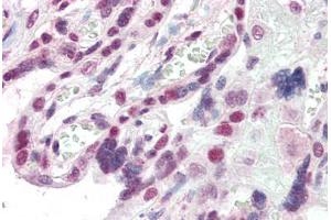 Human Placenta (formalin-fixed, paraffin-embedded) stained with CBX1 antibody ABIN337122 at 2. (CBX1 anticorps  (AA 69-81))