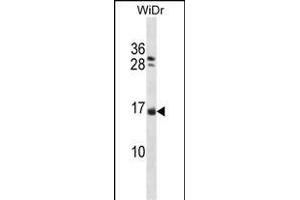 NHLH1 Antibody (Center) (ABIN1538365 and ABIN2848569) western blot analysis in WiDr cell line lysates (35 μg/lane). (NHLH1 anticorps  (AA 38-67))
