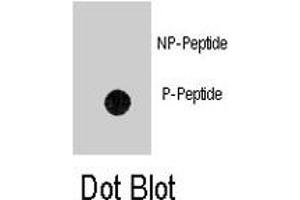 Dot blot analysis of ANTXR1 (phospho Y382) polyclonal antibody  on nitrocellulose membrane. (ANTXR1 anticorps  (pTyr382))