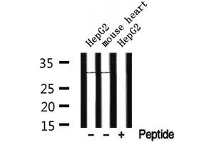 Western blot analysis of extracts from HepG2 and mouse heart, using CYB5R2 Antibody. (CYB5R2 anticorps  (Internal Region))