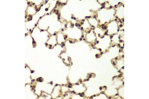 Immunohistochemistry (IHC) image for anti-DNA Repair Protein Complementing XP-B Cells (ERCC3) (AA 513-782) antibody (ABIN3022427) (ERCC3 anticorps  (AA 513-782))