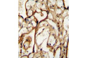 Immunohistochemistry (IHC) image for anti-Solute Carrier Family 3 (Activators of Dibasic and Neutral Amino Acid Transport), Member 2 (SLC3A2) antibody (ABIN2995541) (SLC3A2 anticorps)