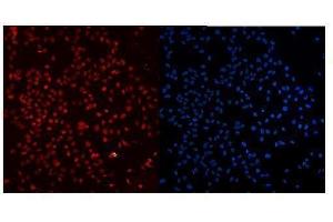IF analysis of Ku80 using anti-Ku80 antibody (ABIN3043964).