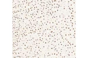 Immunohistochemistry of paraffin embedded rat adrenal gland using RBM8A (ABIN7075478) at dilution of 1: 300 (300x lens) (RBM8A anticorps)