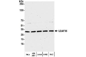 Western Blotting (WB) image for anti-U2 Small Nuclear RNA Auxiliary Factor 1 (U2AF1) (AA 140-190) antibody (ABIN7453889) (U2AF1 anticorps  (AA 140-190))