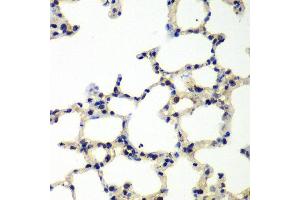 Immunohistochemistry of paraffin-embedded rat lung using PNKP antibody at dilution of 1:100 (x40 lens). (PNKP anticorps)