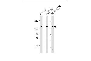 All lanes : Anti-TI Antibody (C-term) at 1:2000 dilution Lane 1: Ramos whole cell lysate Lane 2: HC whole cell lysate Lane 3: RI 8226 whole cell lysate Lysates/proteins at 20 μg per lane. (TIAM1 anticorps  (C-Term))