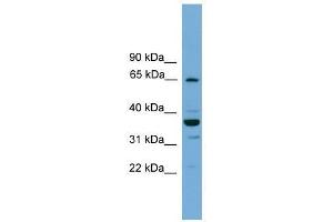 Western Blot showing TH1L antibody used at a concentration of 1-2 ug/ml to detect its target protein. (TH1-Like anticorps  (N-Term))