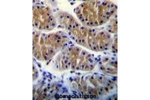 anti-Ankyrin Repeat Domain 5 (ANKRD5) (AA 728-757), (C-Term) antibody