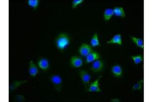 Immunofluorescence staining of A549 cells with ABIN7154549 at 1:44, counter-stained with DAPI. (GDF5 anticorps  (AA 202-501))