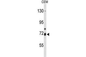 Western blot analysis of ALOX15B Antibody (C-term) in CEM cell line lysates (35µg/lane). (ALOX15B anticorps  (C-Term))