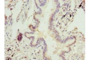 Immunohistochemistry of paraffin-embedded human lung tissue using ABIN7143016 at dilution of 1:100