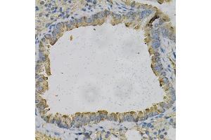 Immunohistochemistry of paraffin-embedded mouse lung using NEK2 Antibody (ABIN5973091) at dilution of 1/100 (40x lens). (NEK2 anticorps)