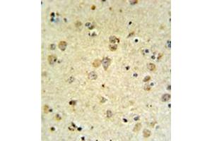 Immunohistochemistry analysis in formalin fixed and paraffin embedded brain tissue reacted with MAP4K3 Antibody , which was peroxidase conjugated to the secondary antibody and followed by DAB staining. (MAP4K3 anticorps)