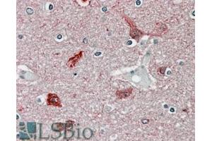 ABIN570984 (3. (CaMKII alpha/beta (Internal Region) anticorps)