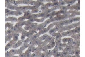Detection of C9 in Rabbit Liver Tissue using Polyclonal Antibody to Complement Component 9 (C9)