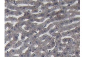 Detection of C9 in Rabbit Liver Tissue using Polyclonal Antibody to Complement Component 9 (C9) (C9 anticorps  (AA 139-519))