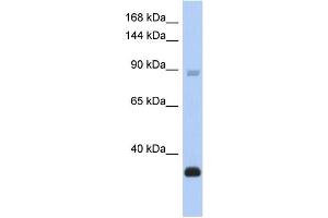 WB Suggested Anti-BCL11B Antibody Titration:  0. (BCL11B anticorps  (Middle Region))
