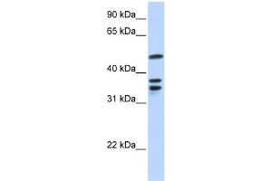 WB Suggested Anti-ETV6 Antibody Titration:  0. (ETV6 anticorps  (N-Term))