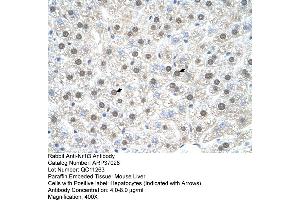 Mouse Liver (NR1I3 anticorps  (C-Term))