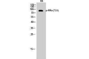 Western Blotting (WB) image for anti-conserved Helix-Loop-Helix Ubiquitous Kinase (CHUK) (pThr23) antibody (ABIN3182039)