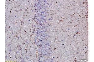 Formalin-fixed and paraffin embedded: rat brain tissue Anti-GFAP Polyclonal Antibody, Unconjugated  at 1:400, followed by conjugation to the secondary antibody and DAB staining (GFAP anticorps  (AA 51-150))