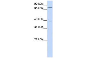 WB Suggested Anti-C17orf80 Antibody Titration:  0. (HLC8 anticorps  (N-Term))