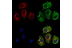 ITIH1 Antibody staining Hela cells by IF/ICC. (ITIH1 anticorps  (Internal Region))
