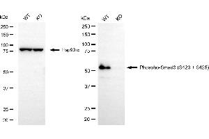 Western blotting analysis using phospho-Smad3 (S423 + S425) antibody (ABIN7800373). (Recombinant SMAD3 anticorps  (pSer423, pSer425))