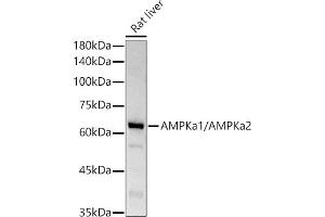 Western blot analysis of extracts of Rat liver, using AMPKa1/AMPKa2 antibody (ABIN6129902, ABIN6136848, ABIN6136849 and ABIN7101410) at 1:1000 dilution. (AMPK alpha anticorps)