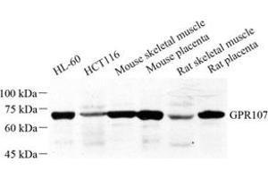 Western blot analysis of GPR107 (ABIN7073995) at dilution of 1: 500 (GPR107 anticorps)