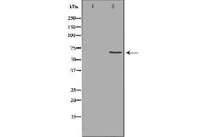 Western blot analysis of extracts of hela , using MMP14 antibody. (MMP14 anticorps  (C-Term))