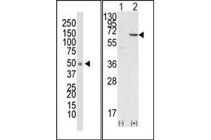 Image no. 1 for anti-Docking Protein 1, 62kDa (Downstream of tyrosine Kinase 1) (DOK1) (N-Term) antibody (ABIN359958) (DOK1 anticorps  (N-Term))