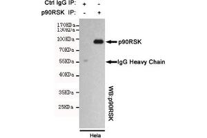Immunoprecipitation analysis of Hela cell lysates using p90RSK mouse mAb.